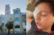 7-year-old goes for surgery, doctor operates on wrong eye